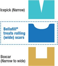 Bellafill